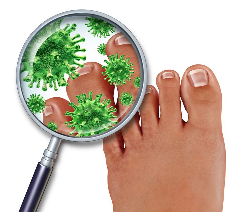 Where does toenail fungus come from 