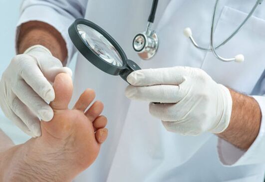 Treatment of mushroom