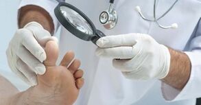 The doctor checks the leg affected by the mushroom